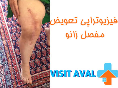 فیزیوتراپی زانو می‌تواند به عنوان یک روش موثر برای بهبود عملکرد زانو در افراد با مشکلات مفصلی زانو مورد استفاده قرار گیرد.