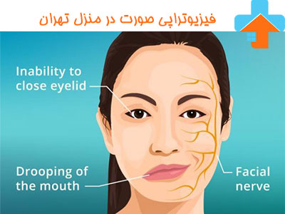 فیزیوتراپی صورت در منزل فیزیوتراپی صورت در منزل تهران