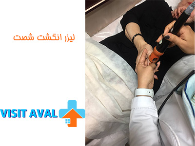 فیزیوتراپی دست در منزل