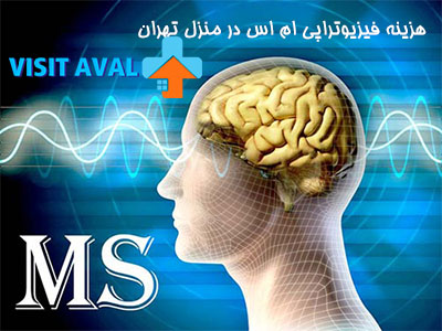 هزینه فیزیوتراپی ام اس در منزل تهران