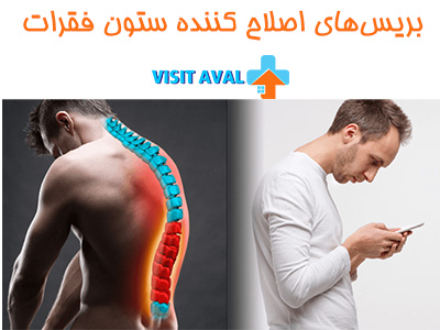 بریس‌های اصلاح کننده ستون فقرات