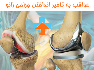 عواقب به تاخیر انداختن جراحی زانو