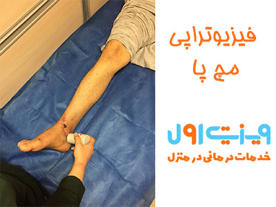 برنامه فیزیوتراپی مچ پا با تمرینات مخصوص، یک راهکار شخصی‌سازی شده است که به بهبود عملکرد و تقویت مچ پا، افزایش استحکام عضلات و کاهش مشکلات حاصل از آسیب‌های مچ کمک می‌کند.