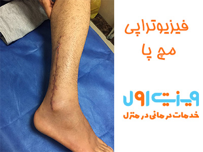استفاده از فیزیوتراپی پا در منزل با تمرینات ساده و موثر، یک راهکار کارآمد برای تقویت عضلات پا، بهبود تعادل و کاهش دردهای مرتبط با این ناحیه می‌باشد.