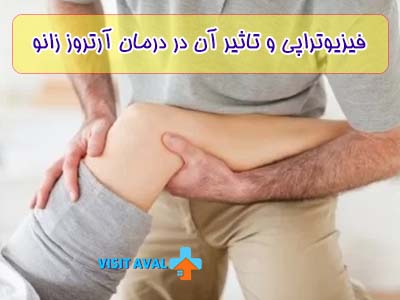 فیزیوتراپی با استفاده از تمرینات تقویتی و کششی، تاثیر قابل توجهی در کاهش درد و بهبود عملکرد مفصل در درمان آرتروز زانو دارد.