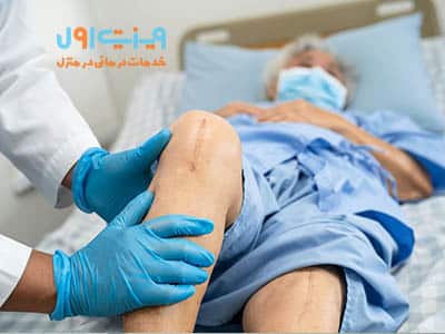فعالیت‌های بعد از تعویض مفصل زانو باید شامل تمرینات فیزیوتراپی ملایم و پیاده‌روی کوتاه برای تقویت عضلات و افزایش دامنه حرکتی باشد.