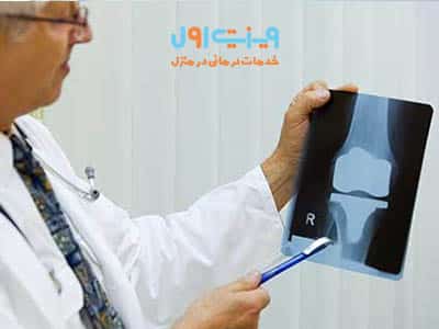 پیش از جراحی تعویض مفصل زانو، انجام تمرینات تقویتی برای عضلات اطراف زانو و کاهش وزن برای کاهش فشار روی مفصل جدید توصیه می‌شود.