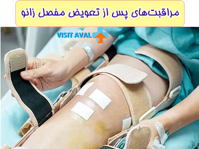 مراقبت‌های پس از تعویض مفصل زانو شامل استفاده منظم از داروهای ضد درد، تمرینات فیزیوتراپی و پرهیز از فعالیت‌های سنگین برای تسریع روند بهبودی است.