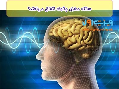 سکته مغزی یک وقایع حاد و ناگهانی است که اغلب ناشی از بلاک شدن یا پارگی عروق خونی در مغز می‌شود، این حادثه باعث قطعی ارتباطات نورونی و آسیب به بافت‌های مغزی می‌شود.