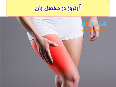 امکان دارد آرتروز در هر یک از مفاصل پای شما باشد.