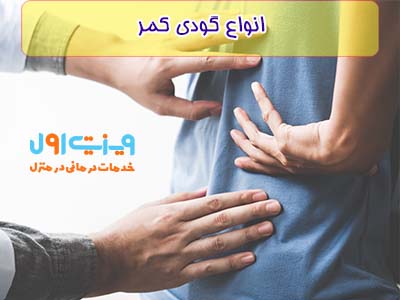 چند مدل گودی کمر داریم:گودی کمر وضعیتی، مادرزادی و گودی کمری که براثر فشار به وجود آمده است.