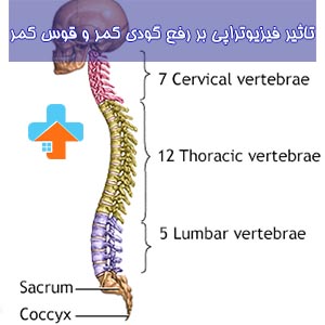 تاثیر فیزیوتراپی در رفع گودی کمر بسیار قابل توجه می‌باشد.