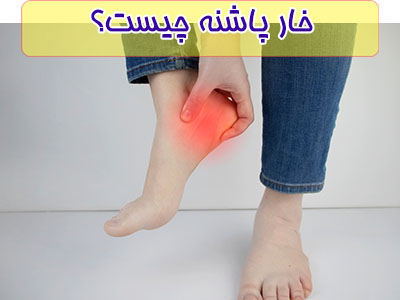 اگر یک استخوان در کف پای شما رشد کرد است این زايده خارپاشنه است.