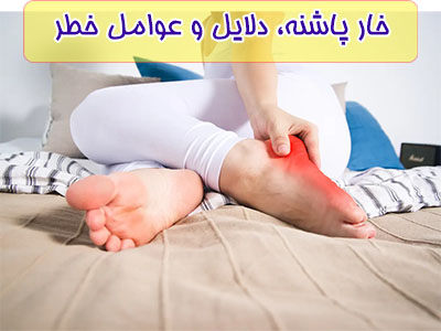 تجمع کلسیم در کف پا باعث ایجاد خارپاشنه می‌شود.