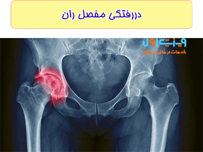 با استفاده از ضربه محکم به مفصل ران که مثل گوی است دچار در رفتگی می شود.