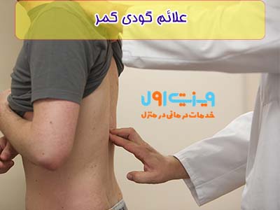 از علائم گودی کمر میتوان به درد در ناحیه کمر و کوتاه بودن قد اشاره کرد.