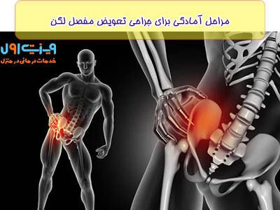 یکی از مراحل آمادگی برای جراحی تعویض مفصل لگن شامل انجام آزمایشات پزشکی مانند خون‌گیری و عکسبرداری برای ارزیابی سلامت عمومی و وضعیت مفصل است.