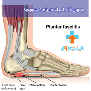 اگر خارپاشنه دارید و این درد داره اذیتتون میکند پس این مطل که در مورد چجوری از خارپاشنه راحت شویم را مطالعه کنید