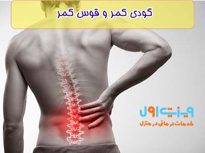 ستون فقرات در حالت معمول صاف نیست، ولی اگر این غیر صاف بودن از حد طبیعی بیشتر شود گودی کمر می‌گویند.