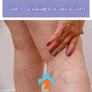 یکی از روش های موثر در درمان واریس پا فیزیوتراپی پا در منزل می‌باشد.