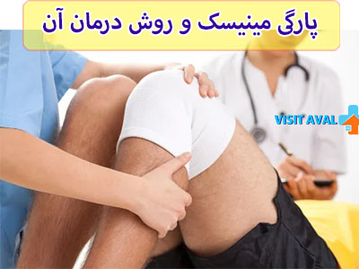 پارگی مینیسک بسته به شدت آسیب، با روشهای درمانی مختلفی مانند فیزیوتراپی، تزریق، یا در موارد شدیدتر، جراحی ترمیمی قابل بهبود است.