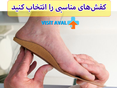 نخستین پیشنهادی که یک پزشک متخصص برای درمان کف پای صاف پیشنهاد میدهد، انتخاب کفش مناسب است.