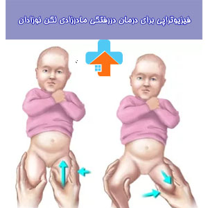 فیزیوتراپی درمانی برای دررفتگی مادرزادی لگن نوزادان می‌تواند بهبود موقعیت و عملکرد این منطقه حیاتی را تسریع کند.