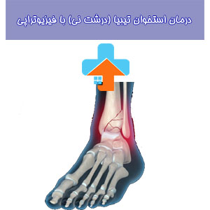 شکستگی استخوان تیبیا ممکن است نیاز به درمان استخوان درشت نی داشته باشد که در آن فیزیوتراپی برای بهبودی و تقویت استخوان تیبیا از اهمیت بالایی برخوردار است.