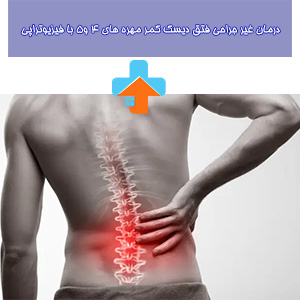 فیزیوتراپی مهره‌های 4 و 5 کمر می‌تواند در درمان فتق دیسک این منطقه بهبود چشمگیری ایجاد کند.