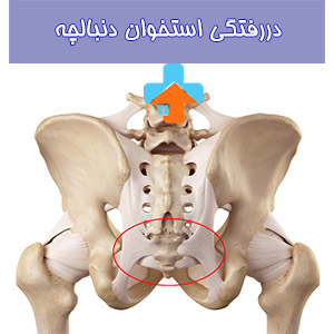 دررفتگی استخوان، با علائم مختلفی همچون درد و سرخی پوست در ناحیه مبتلا، نیازمند تشخیص دقیق و درمان جهت بهبود وضعیت استخوانی است.