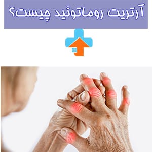 آرتریت روماتوئید، یک بیماری التهابی است که مفاصل را تحت تاثیر قرار می‌دهد و فیزیوتراپی می‌تواند در بهبود علائم و کاهش درد روماتیسم مفصلی مؤثر باشد.