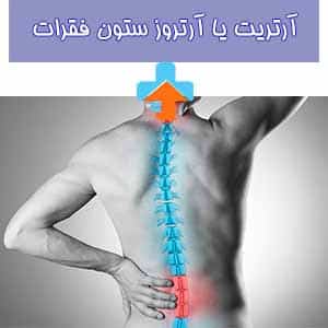 علائم آرتروز ستون فقرات شامل درد مزمن، سفتی و کاهش انعطاف‌پذیری در ناحیه پشت و گردن است که می‌تواند حرکت را برای فرد دشوار کند.