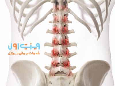 دلایل بروز آرتروز ستون فقرات شامل افزایش سن، فرسایش طبیعی غضروف‌ها، و عوامل ژنتیکی می‌شود که به تدریج منجر به تحلیل رفتن مفاصل می‌گردد.