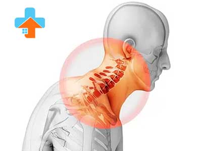 نحوه درمان بیرون زدگی دیسک گردن بسته به شدت علائم می‌تواند شامل فیزیوتراپی و تمرینات تقویتی باشد تا به بهبود حرکت و کاهش درد کمک کند.