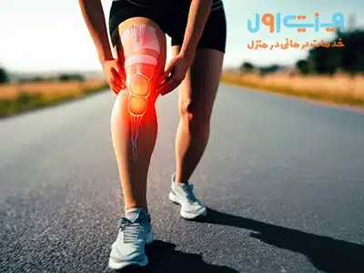 برای پیشگیری از درد پشت زانو، تقویت عضلات اطراف زانو و حفظ وزن متعادل اهمیت زیادی دارد.