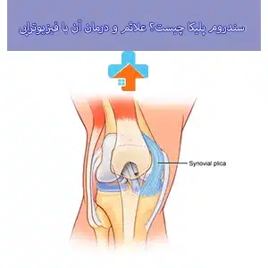 سندروم پلیکا زانو می‌تواند باعث ایجاد درد و التهاب در مفصل زانو شود که معمولاً با علائمی مانند تورم و کاهش دامنه حرکتی همراه است.