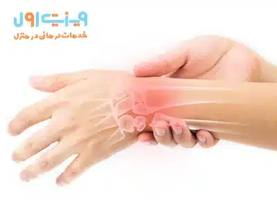 این وضعیت به ورم و تحریک تاندونها در ناحیه مچ دست اشاره دارد که میتواند به دلیل استفاده زیاد یا آسیبهای ورزشی ایجاد شود.
