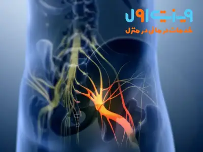 سندروم دم اسبی (Cauda Equina) به آسیب یا فشردگی اعصاب در ناحیه انتهایی ستون فقرات اطلاق میشود که میتواند علائم جدی حرکتی و حسی ایجاد کند.