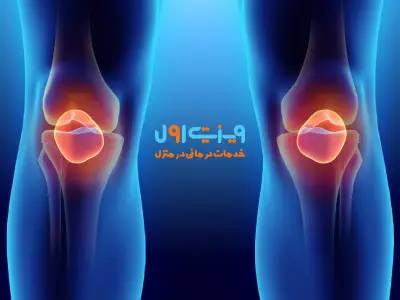 چگونگی نحوه تشخیص ناپایداری کشکک زانو شامل بررسی بالینی، ارزیابی دامنه حرکتی و آزمایش‌های تخصصی ارتوپدی است.