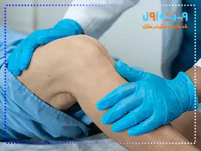  این عارضه معمولاً با کاهش دامنه حرکتی، احساس سفتی و ناتوانی در خم یا صاف کردن زانو همراه است.