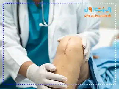 خشکی زانو پس از جراحی تعویض مفصل یکی از رایج‌ترین عوارض عمل است که می‌توان با فیزیوتراپی و تمرینات منظم آن را بهبود بخشید.