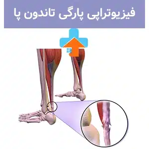 درمان پارگی تاندون پا با فیزیوتراپی می‌تواند به تسریع روند بهبودی و بازگشت به فعالیت‌های روزمره کمک کند.