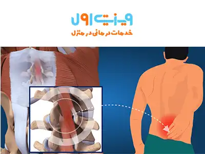 درد گودی کمر ممکن است به دلیل ضعف عضلات حمایتکننده ستون فقرات ایجاد شود و در صورت عدم درمان، مشکلاتی مانند دیسک کمر یا تنگی کانال نخاع را به دنبال داشته باشد.