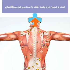 سندرم درد میوفاسیال باعث ایجاد درد مزمن در عضلات و ظهور علائم درد میوفاسیال مانند حساسیت و نقاط دردناک می‌شود.