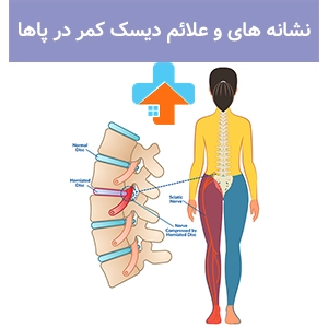 علائم درد دیسک کمر در پاها معمولاً شامل بی‌حسی، گزگز و ضعف عضلانی است که می‌تواند حرکت را محدود کند.