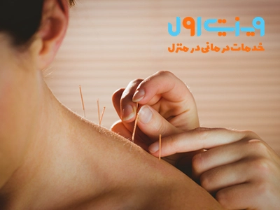 درمان فیبرومیالژیا با طب سوزنی می‌تواند به کاهش دردهای مزمن، بهبود کیفیت خواب و افزایش سطح انرژی بیماران کمک کند.
