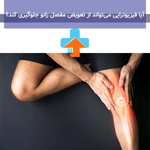 فیزیوتراپی برای جلوگیری از تعویض مفصل زانو یکی از موثرترین روش‌های درمانی است که می‌تواند نیاز به جراحی را به تعویق بیندازد یا حتی کاملاً برطرف کند.