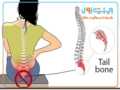 درد استخوان دنبالچه معمولاً هنگام نشستن طولانی‌مدت تشدید می‌شود و می‌تواند فعالیت‌های روزمره را با اختلال مواجه کند.