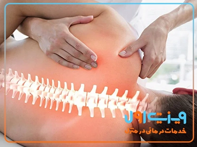 درمان خشکی مهره کمر با ترکیبی از ورزش‌های تخصصی و تقویت ماهیچه‌های اطراف ستون فقرات می‌تواند به بهبود حرکت و کاهش درد کمک کند.