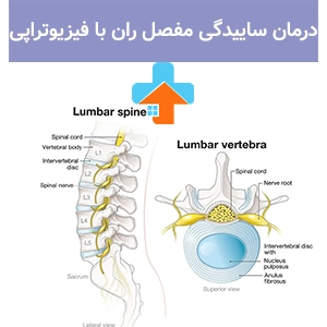 در صورت ابتلا به ساییدگی مفصل ران، استفاده از فیزیوتراپی مفصل ران می‌تواند درد و محدودیت حرکتی را بدون نیاز به جراحی کاهش دهد.